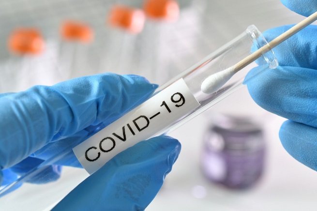 Read more about the article <strong>Ράπιντ τεστ</strong> <strong>Covid-19 <a>την Τρίτη 6 Δεκεμβρίου </a>στην Αρχαία Ολυμπία</strong>